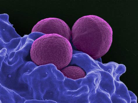 New Class Of Antibiotics To Fight Off Drug Resistant Bacteria