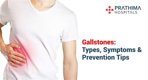 Gallstones Types Symptoms And Prevention Tips Prathima Hospitals