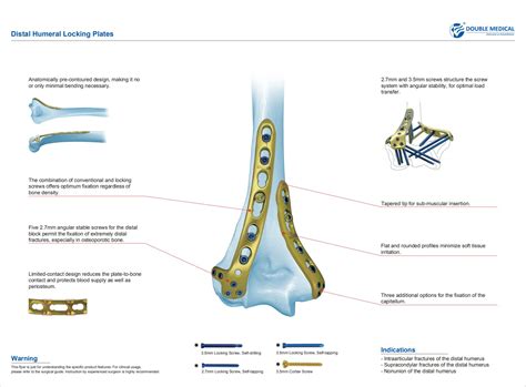 Distal Humeral Locking Plate Ⅱmedical Device Manufacturers Double Medical