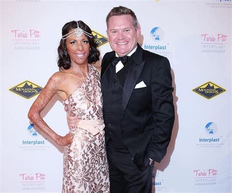 Turia Pitt And Michael Hoskin Love Story In Pictures Love Story Lucky Girl Burn Survivor