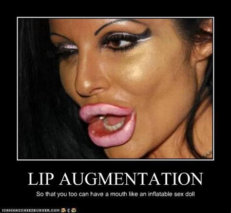 Lip Augmentation Cheezburger Funny Memes Funny Pictures
