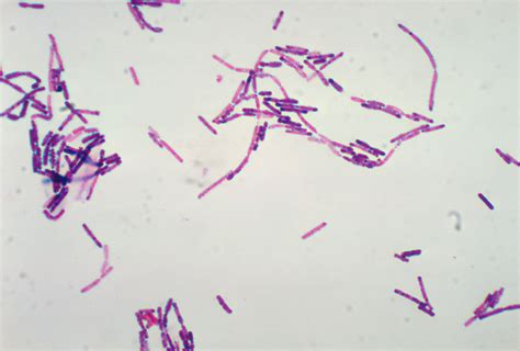 Bacillus Cereus Gram Staining Doccheck