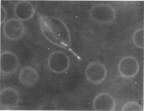 Dark Field Micrographs Of Human Red Cell Ghosts Incubated With Download Scientific Diagram