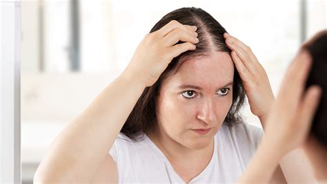 How To Find The Best Treatments For Female Pattern Hair Loss Goodrx