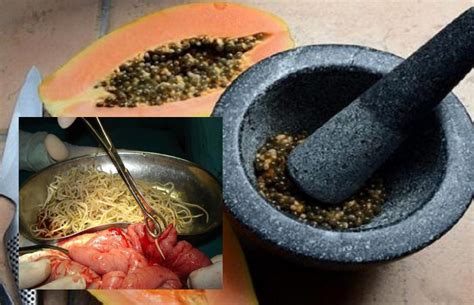 Jangkitan kuman dalam darah dewasa. Petua Semulajadi Bunuh Cacing Dalam Badan, Tak Perlu Pergi ...