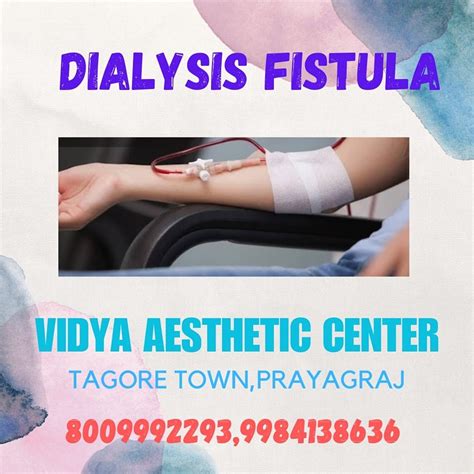 Dialysis Fistula Vidya Aesthetic Center Vidya Aesthetics