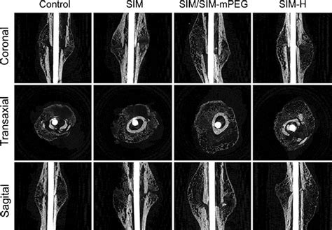 Representative Micro Ct Images Of The Healing Of Fractured Femurs On