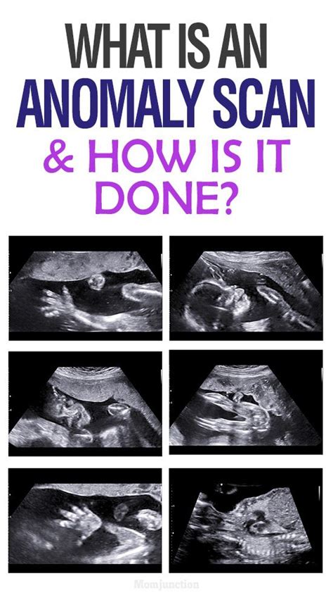 What Is Anomaly Scan During Pregnancy And Why Is It Done Pregnancy