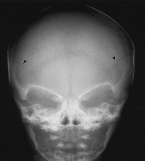 X Ray Of Skull Images Digital Pictures Downloads