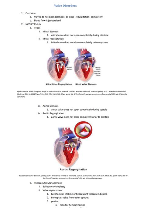 Nclex Cardiac Points Valve Disorder Nclex Quiz