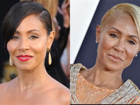 Jada Pinkett Smith Plastic Surgery With Before And After