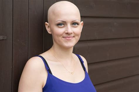 beautiful hairstylist with alopecia reveals bald head for first time in 20 years after lifetime