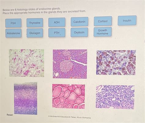 Solved Below Are 6 Histology Slides Of Endocrine Glands Place The
