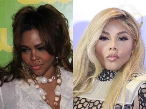 Celebrities Who Bleached Their Skin Before And After Photos Ke