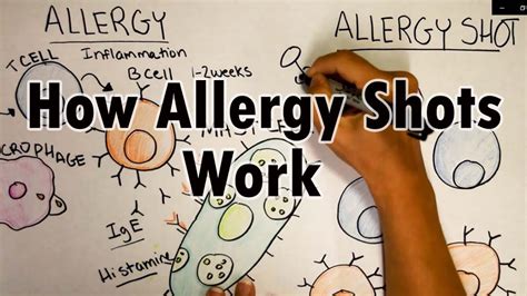 How Do Allergy Shots Work Th2 Cells And Ige Youtube