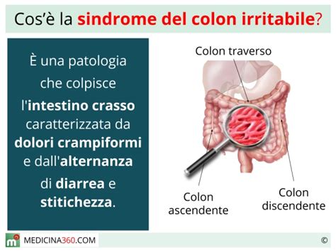 La dieta colon irritabile è una sindrome molto comune che in alcuni casi può essere trattata semplicemente con la dieta, una sana alimentazione. Sindrome del colon irritabile: sintomi, dieta, test e cura