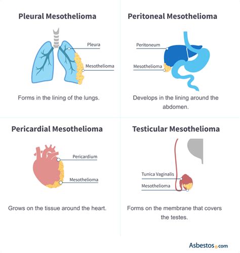 Mesothelioma Overview Symptoms Treatment And Prognosis