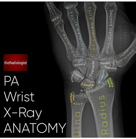 Pin By Charlotte Anne On Xray Anatomy In 2021 X Ray Wrist Anatomy