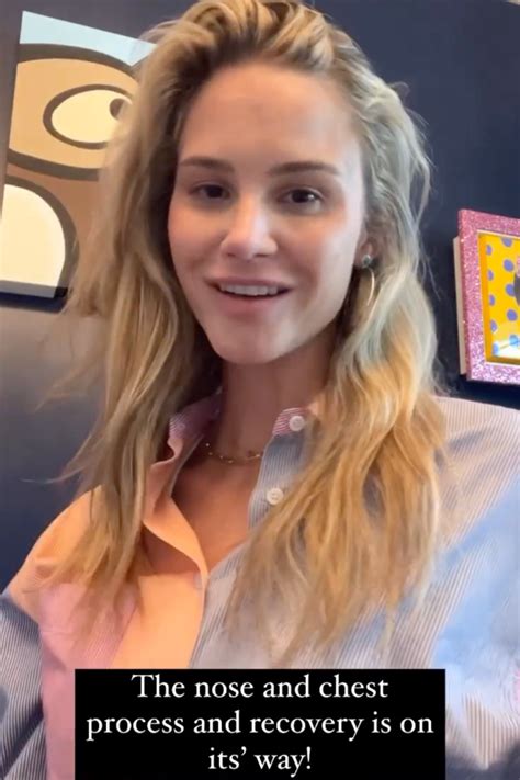 Meghan King Undergoes Nose Boob Jobs Surgery Details Us Weekly