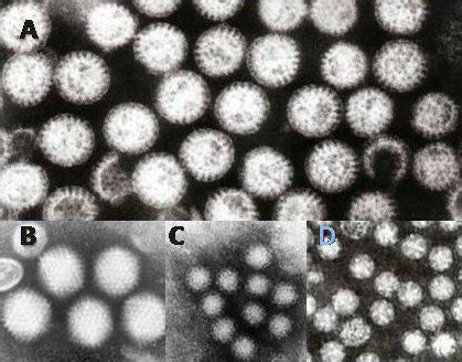 Porcine transmissible gastroenteritis (strain fs772/70). Gastroenteritis - Wikipedia
