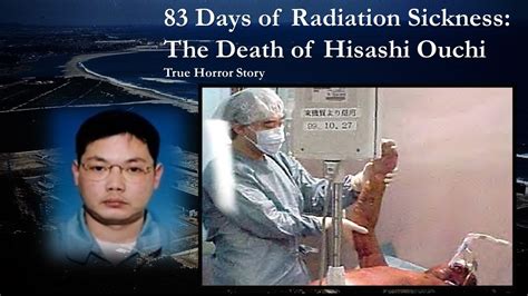 Hisashi Ouchi Radiation Exposure Images And Photos Finder