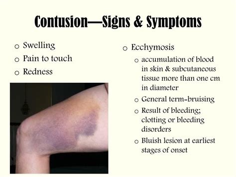 Ppt Skin Wounds Classification Powerpoint Presentation Free Download