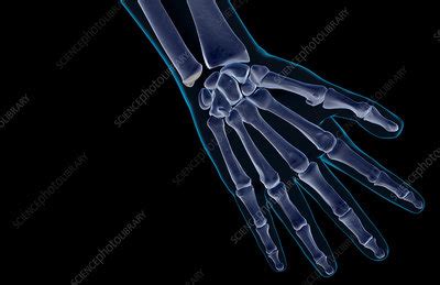 The bones of the hand - Stock Image - F001/5875 - Science Photo Library