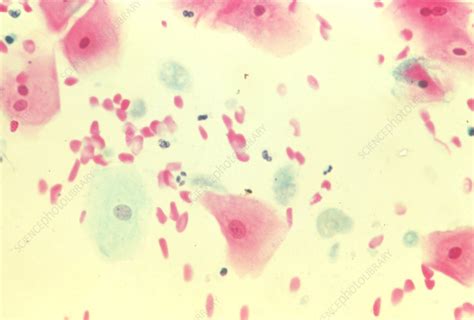 Lm Of Trichomonas Vaginalis In A Cervical Smear Stock Image M Hot Sex