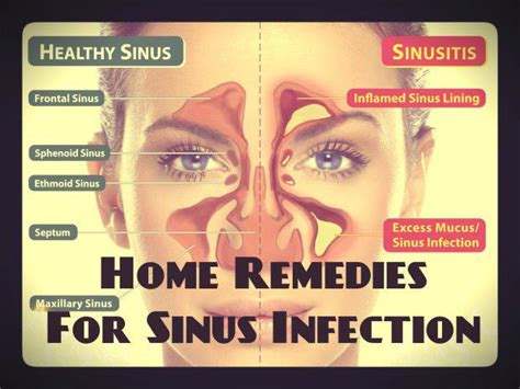 How To Reduce Sinus Infection Swelling Naturally Top 20 Home Remedies