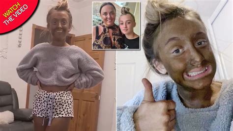 Teen Left Looking Like An Oompa Loompa After Hilarious Fake Tanning