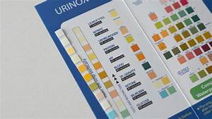 How To Read A Urine Dipstick Test To Detect A Urinary Tract Infection Uti