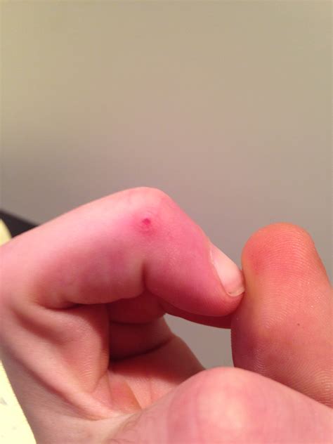 Hello Docs, I have this small bump like thing on my middle