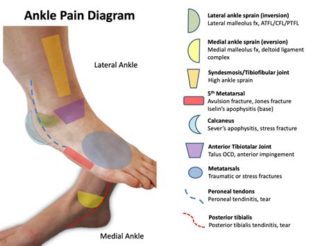 Ankle Ligament Repairs Aptiva Health