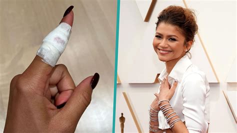 Watch Access Hollywood Highlight Zendaya Gets Stitches After Slicing