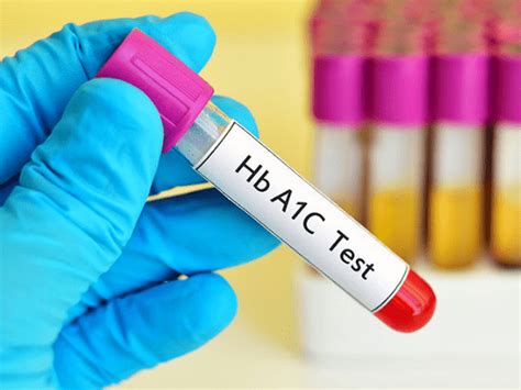 Hba1c Test For Diabetes சர்க்கரை நோயாளிகள் ஏன் 3 மாதத்திற்கு ஒருமுறை