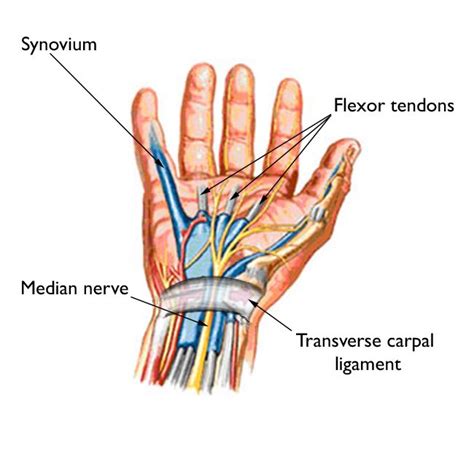 Carpal Tunnel Syndrome Structura Body Therapies