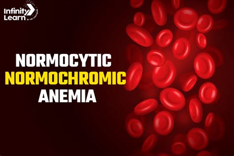 Normocytic Normochromic Amenia Causes Symptoms And Treatment