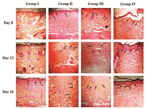 Formation Of Granulation Tissue A H E Staining Of The Wound Tissue My Xxx Hot Girl