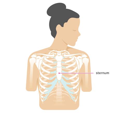 This often worsens when you reach your arms overhead. Broken Sternum: Symptoms, Car Accident, Treatment, and More
