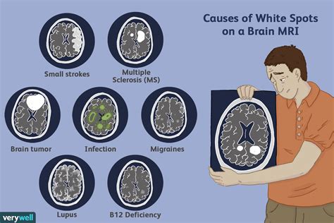 Non Specific Brain Lesions Health Checklist