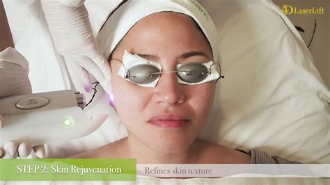 D Laser Lift At Facial Care Centre YouTube