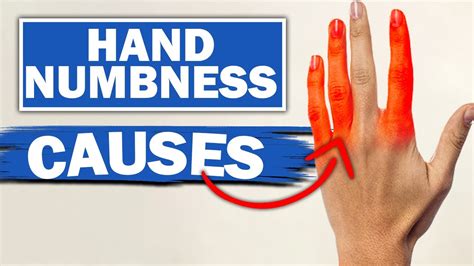 2 Most Common Causes Of Numbness And Tingling In Hand Stretches And Exercises Youtube
