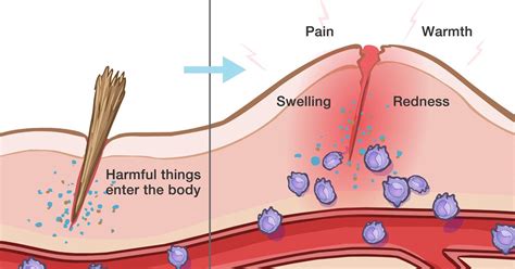 Warning Symptoms Of Hidden Inflammation In The Body Tips To Get