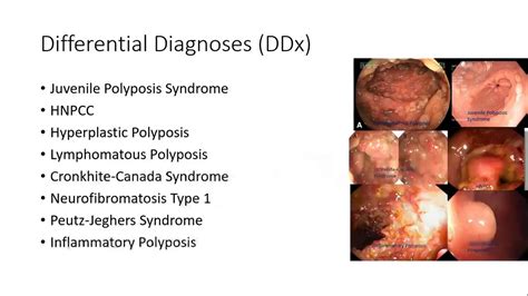 Familial Adenomatous Polyposis Fap Youtube