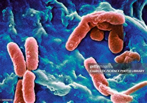 Pseudomonas Aeruginosa Bacteria Sem High Res Stock Photo Getty Images