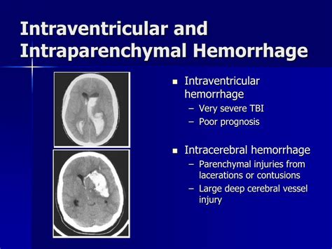 Ppt Traumatic Brain Injury A Case Study Powerpoint Presentation Id