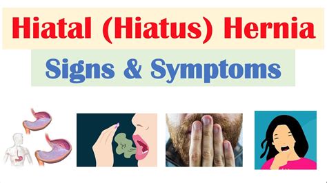 Effective Treatment Hiatal Hernia Relief From Symptoms Medical