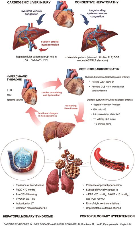 Cardiac Syndromes In Liver Disease A Clinical Conundrum
