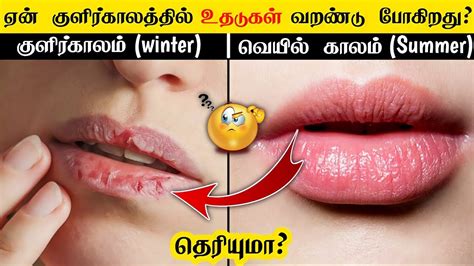ஓஹ இதகக பனனட இவவள வஷயம இரககத why lips get dry at winter season YouTube