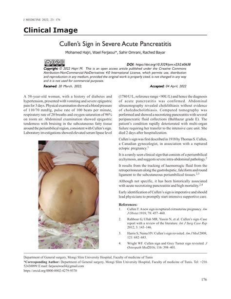 Pdf Cullens Sign In Severe Acute Pancreatitis